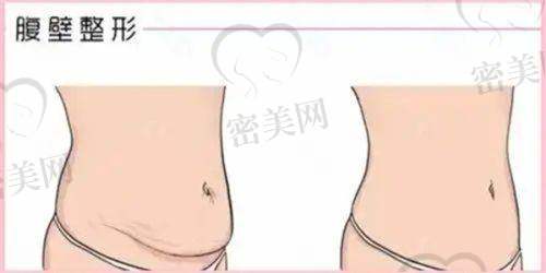纹眉技术与成效