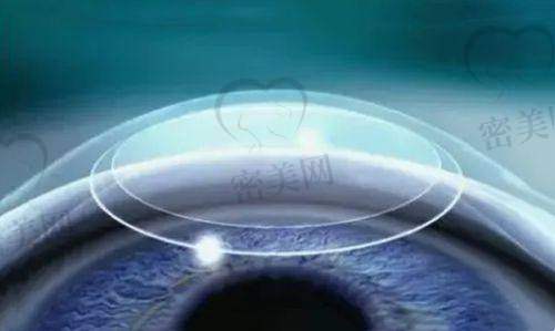 衡水复明眼科医院正规不正规？资质、医生、设备一应俱全