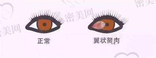 北京大学深圳医院眼科口碑怎么样？