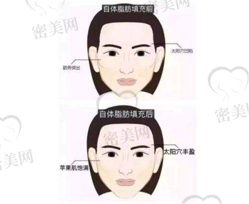 上海联合丽格医疗美容：高阶鼻整形修复有名机构