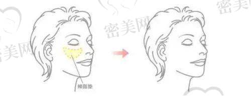 植发项目的特色