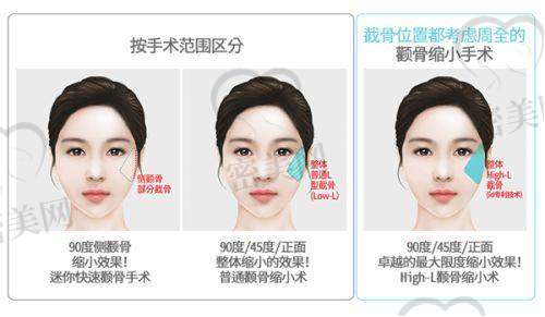与广州韩妃的对比