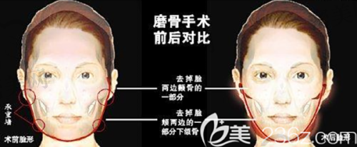 纹眉的意义与价值