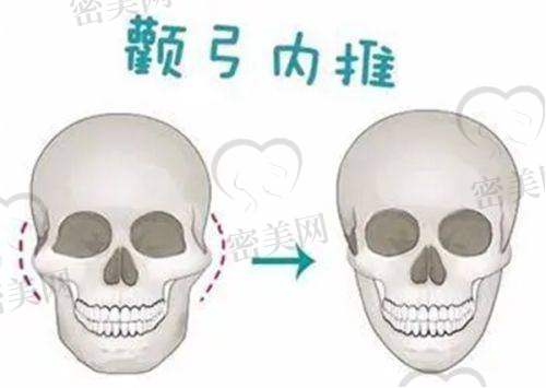 南京友谊医疗美容：骨骼轮廓改造的“精细工匠”