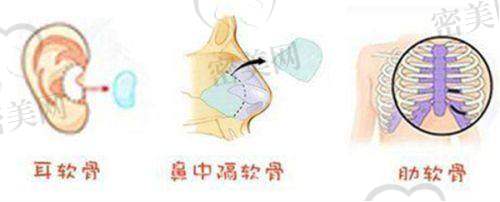 开展项目介绍