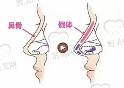 桑建波医生擅长项目：