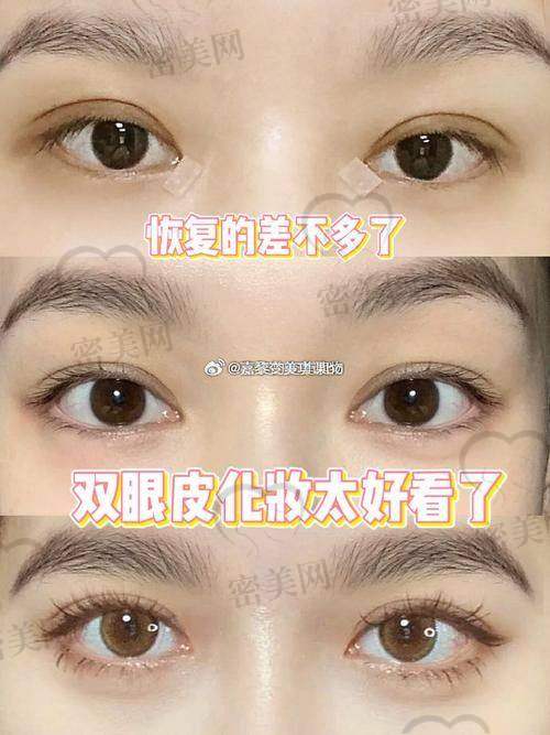 真实患者反馈：术后有哪些改变？