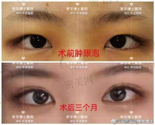 文章结语：不是“大众线条”，而是“逆天改眼神”