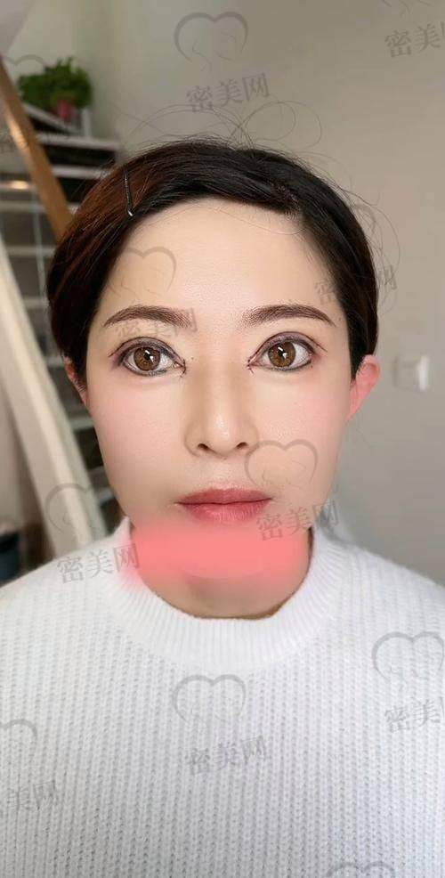 搞懂外眼角 VS 眼睑下至，别再选错啦！