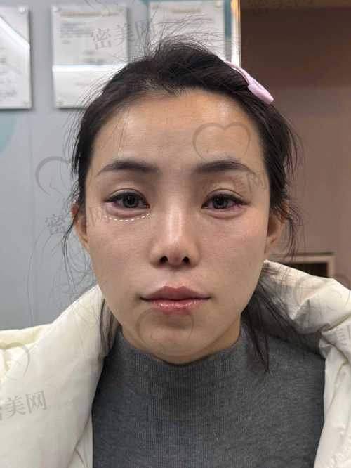 注意事项要牢记