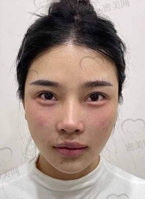 有啥危害不