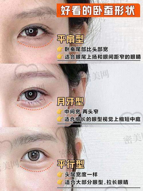做张冰洁真皮卧蚕的至佳时机 & 注意事项