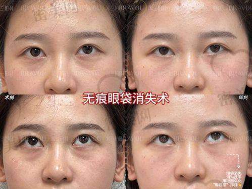 张冰洁医生是谁？贵圈“救眼女神”实至名归