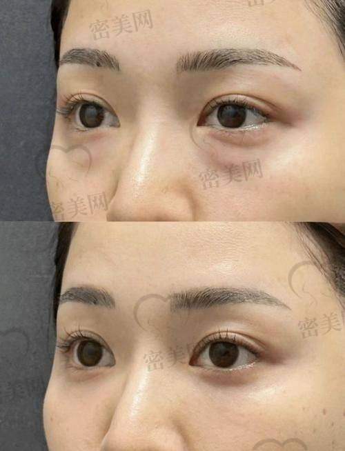 沈阳美莱医疗美容医院 — 李晓东医生