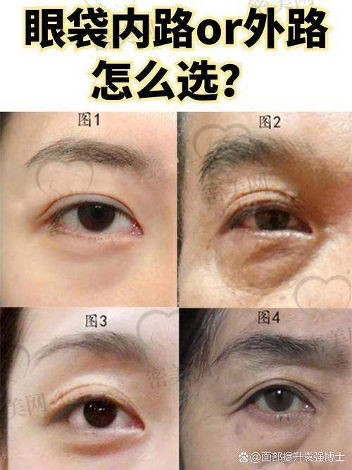 如何预约张冰洁医生？信息看这里