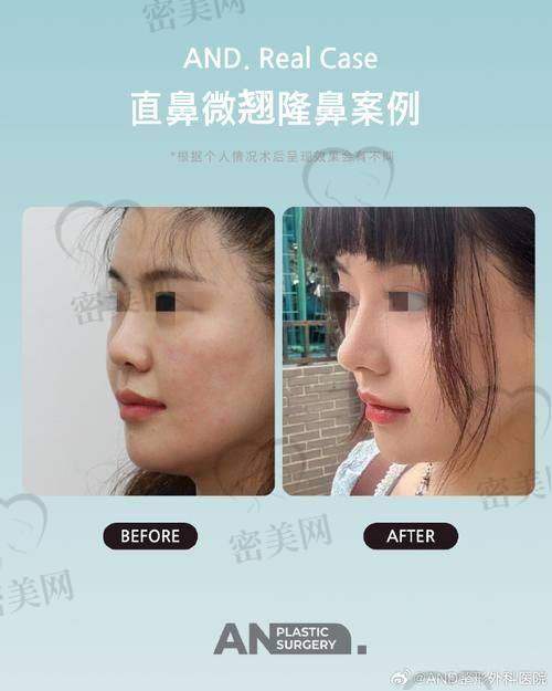 上海叶丽萍医生有哪些成功实例？