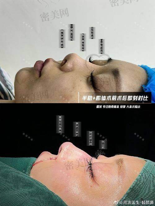 叶丽萍医生出诊信息揭秘！