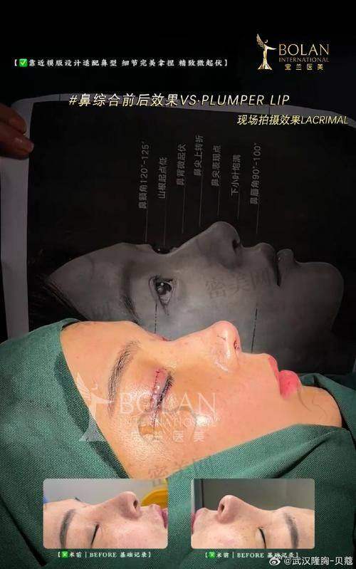 上海叶丽萍医生口碑咋样？