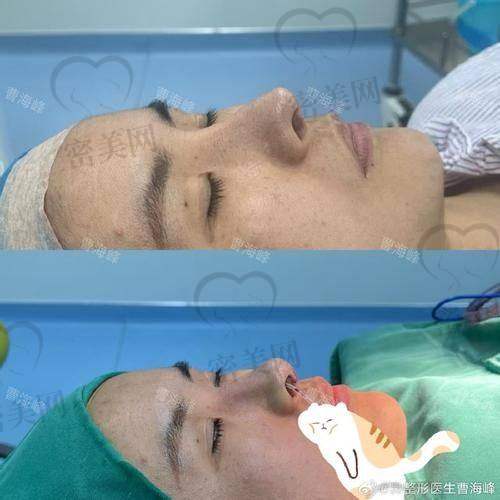 上海华美李健和谢卫国哪个好，收费标准大揭秘！