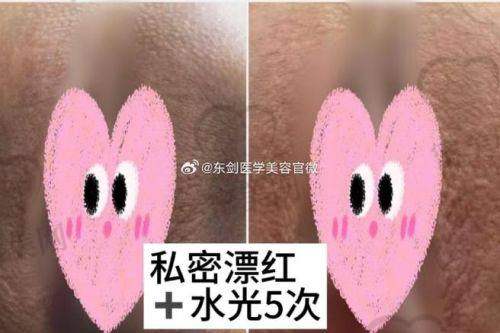西安壹加壹医疗美容：短时修复术式，有效无痕