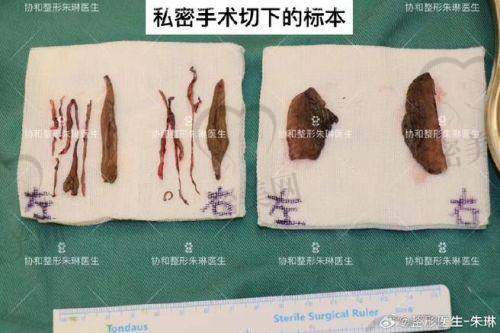 西安现代美容整形医院：精细手术为主，重视术后自然感