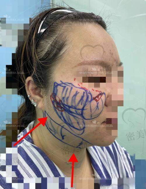 填充风险与注意事项