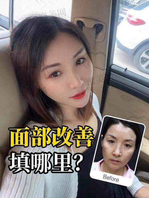 填充时长小秘密