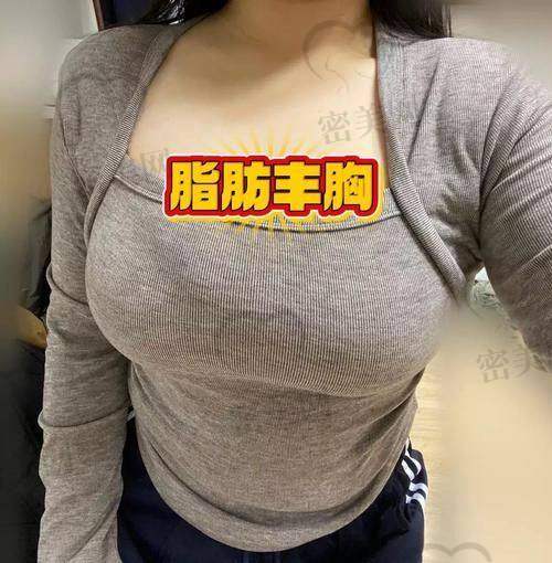 手术体验，紧张又惊喜
