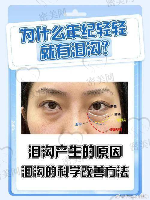 风险与注意事项