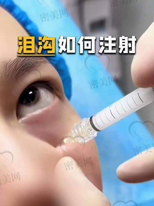 多少钱一针
