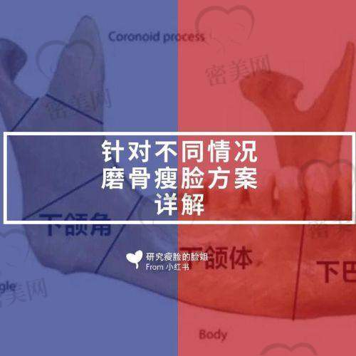 上海李志海磨骨技术怎么样之收费标准大公开