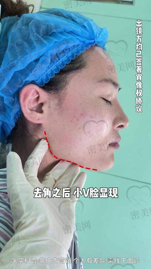 上海李志海磨骨技术怎么样之专精能力大考验