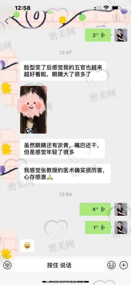上海李志海磨骨技术怎么样之技术优势大比拼