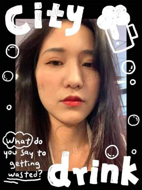 上海华美李志海手术实例大赏