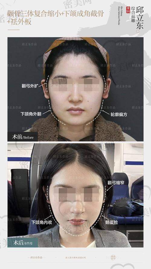 上海华美李志海收费标准咋样