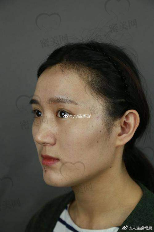 上海华美李志海擅长手术有哪些