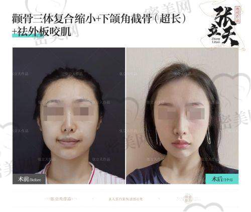 医生技术特色：王东医生的“秘密武器”