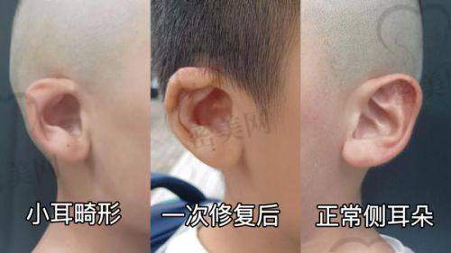 吴煜医生擅长项目：