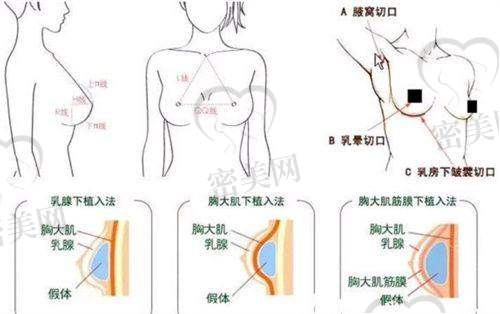 李伟杰医生技术特点：