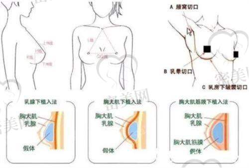 刘杨医生技术特点：