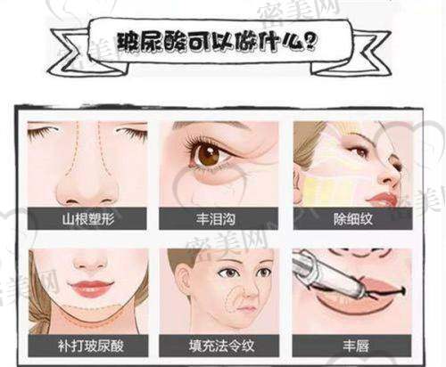 史训吉医生技术特点：