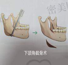 谭立文医生怎么预约挂号？