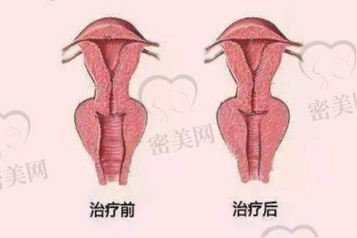 吴煜医生技术特点：