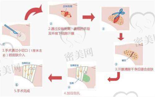李燕飞医生口碑怎么样？