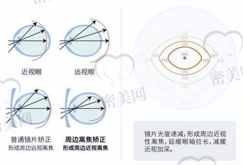 瑞视眼科医院乌鲁木齐院区