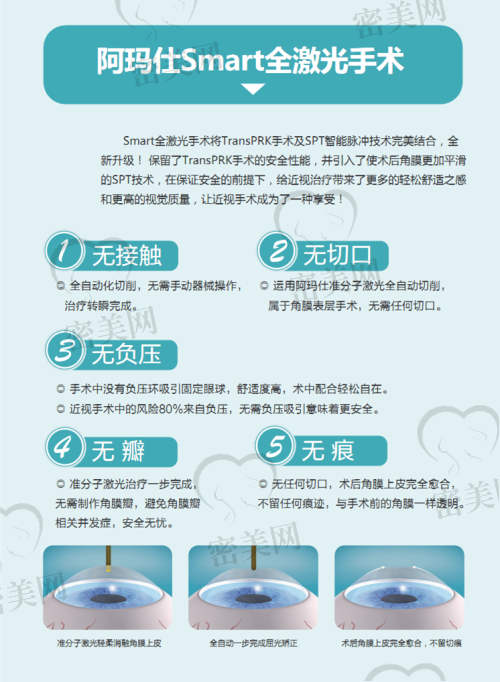 如何根据预算选择阿尔法角膜塑形镜的版本？