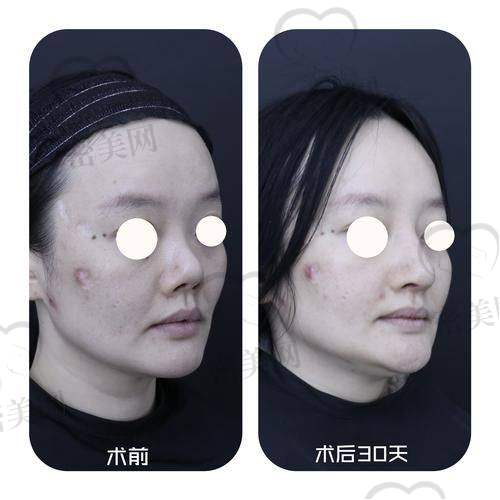 王艳医生的神奇技术
