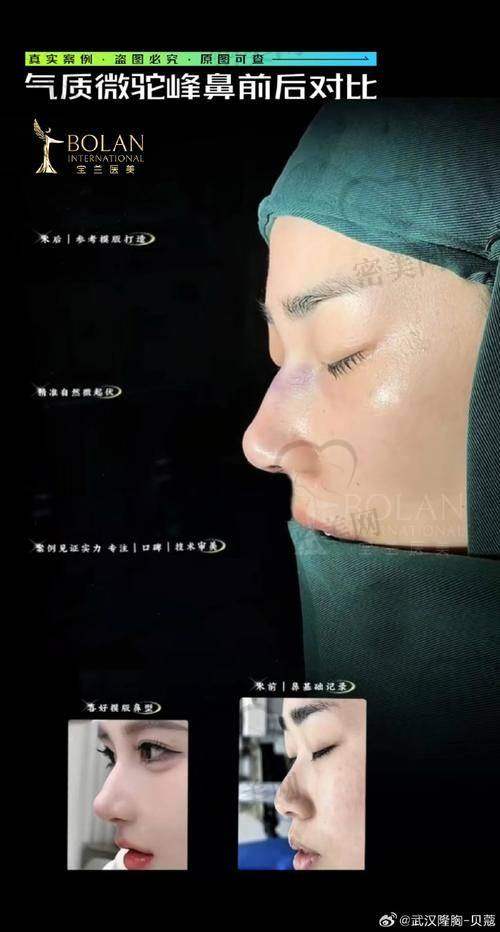真实实例，眼见为实
