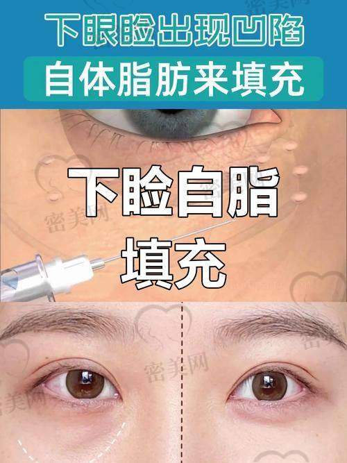专精能力杠杠的张朋医生