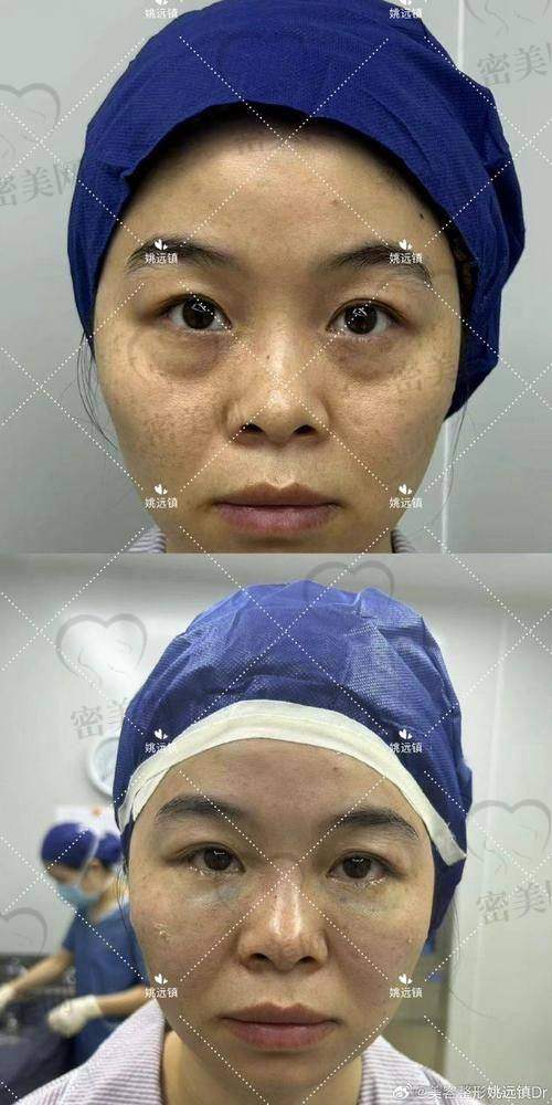 维持时长，是“昙花一现”还是“长长久久”？